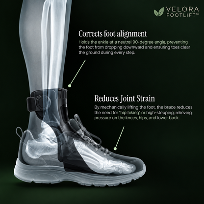 VELORA FOOTLIFT™ — Foot Drop Support Brace